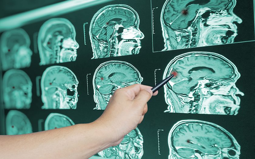 Penyebab Cedera Otak yang Dialami Oleh Penduduk di Texas
