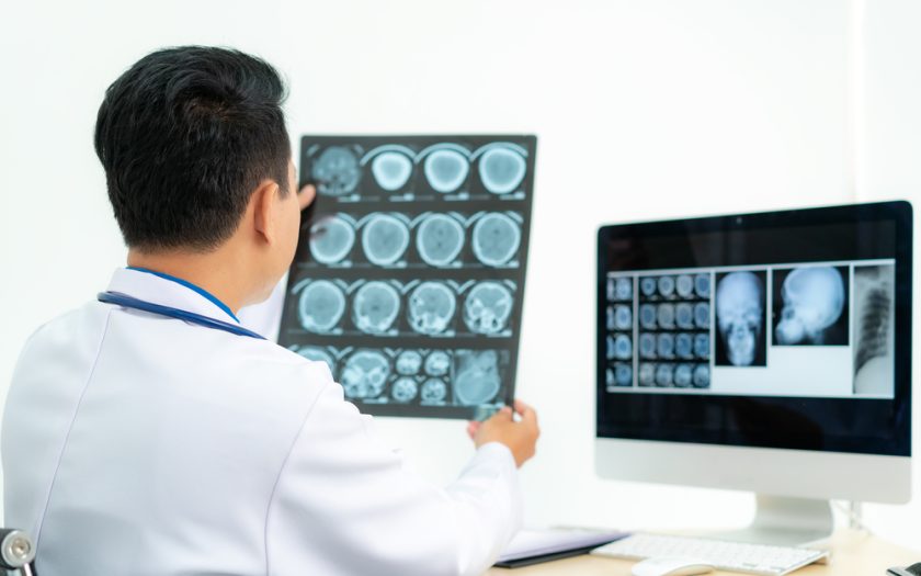 Studi Efektivitas untuk Penyintas Cedera Otak di Amerika Serikat