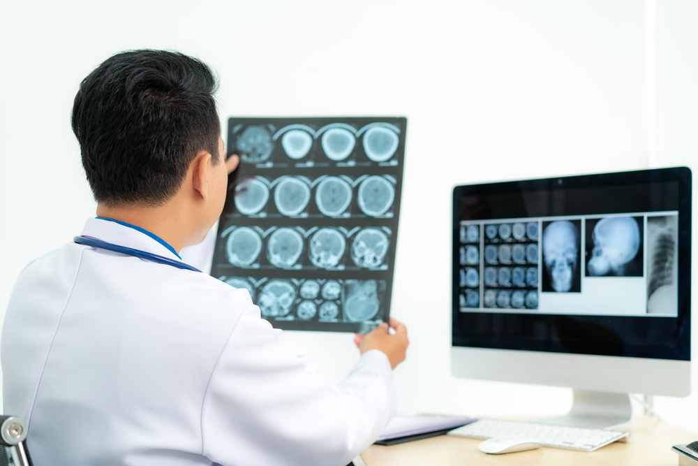 Studi Efektivitas untuk Penyintas Cedera Otak di Amerika Serikat post thumbnail image