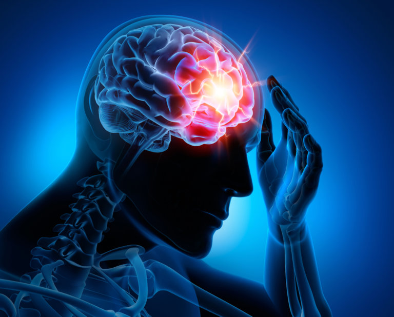 What Do You Know About Brain Injury 